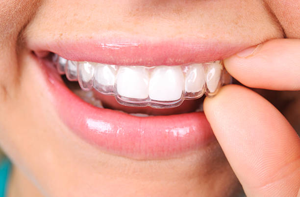 smiling mouth nice teeth, wearing clear aligners Invisalign Honolulu, HI